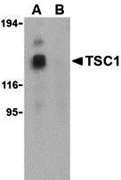 Western blot analysis of TSC1 in EL4 cell lysate with TSC1 antibody at 1 μg/mL in the (A) absence and (B) presence of blocking peptide