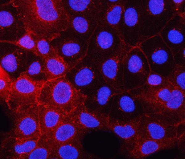 a00366 pdgfra primary antibodies if testing 2