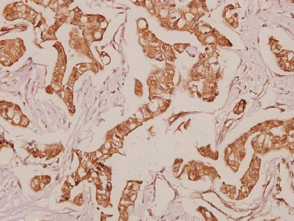 a00366s1057 pdgfra primary antiboties ihc testing 2