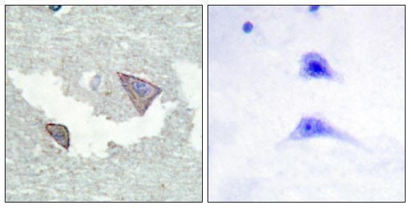 a00366y754 1 pdgfra primary antibodies ihc testing 3