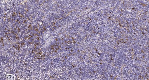 a00366y762 pdgfra primary antibodies ihc testing 1