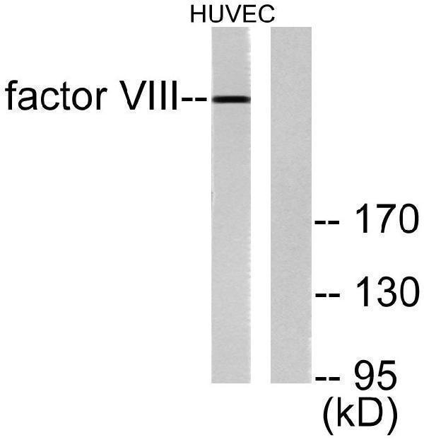 Western blot analysis of lysates from HUVEC cells, using Factor VIII Antibody