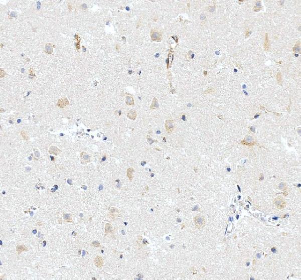 a00368 nos2 primary antibodies ihc testing 1