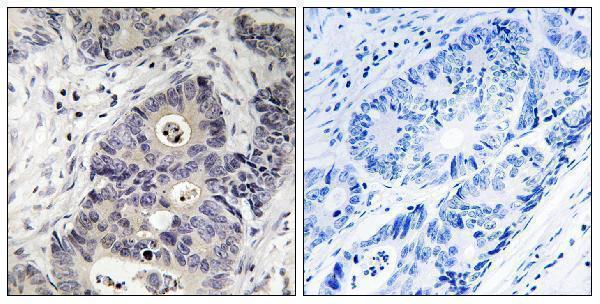 a00368y151 nos2 primary antibodies ihc testing 2