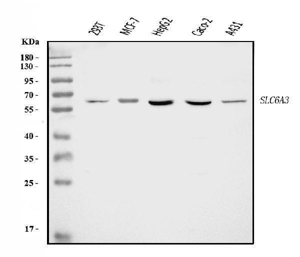  Western blot analysis of Dopamine Transporter/SLC6A3 using anti-Dopamine Transporter/SLC6A3 antibody (A00369-3)