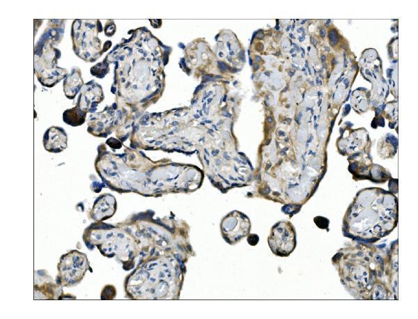 a00370 2 angpt2 primary antibodies ihc testing 6