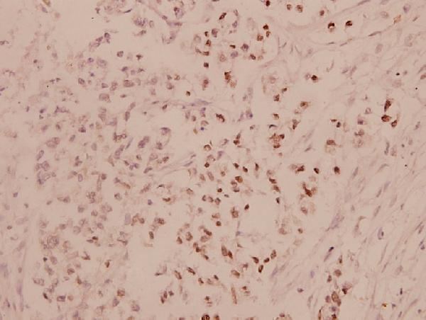 a00371 2 atf4 primary antiboties ihc testing 2