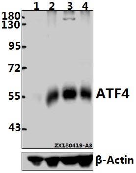 a00371 2 atf4 primary antiboties wb testing 1