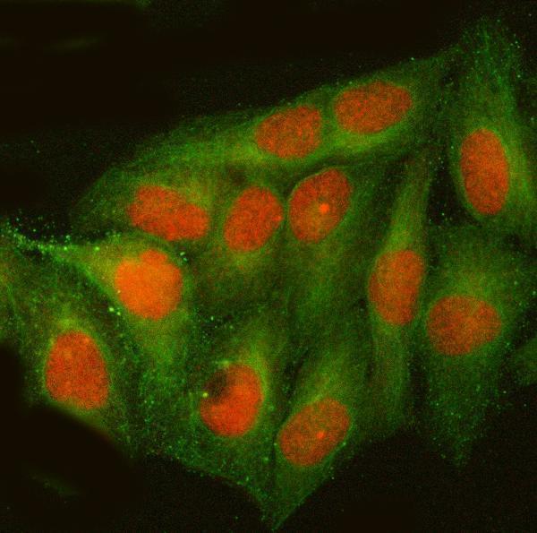 a00371 4 atf4 primary antibodies if testing 2
