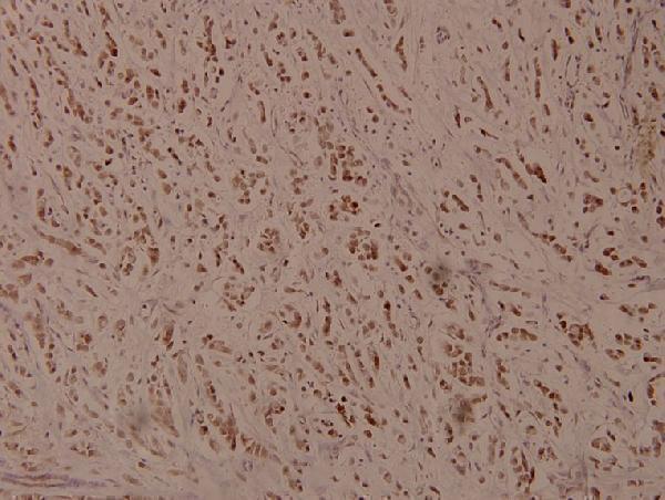 a00371s245 atf4 primary antiboties ihc testing 2