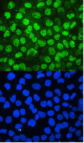 a00374 1 mcm2 primary antibodies icc_if testing 8