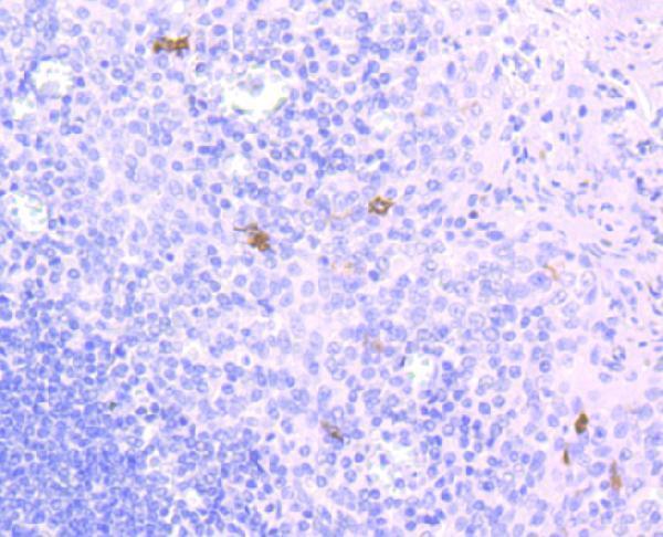Immunohistochemical analysis of paraffin-embedded human tonsil tissue using anti-CD1a antibody