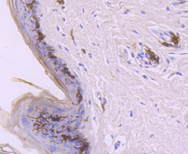 Immunohistochemical analysis of paraffin-embedded human skin tissue using anti-CD1a antibody