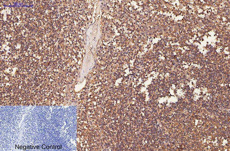 Immunohistochemical analysis of paraffin-embedded Human-Tonsil tissue