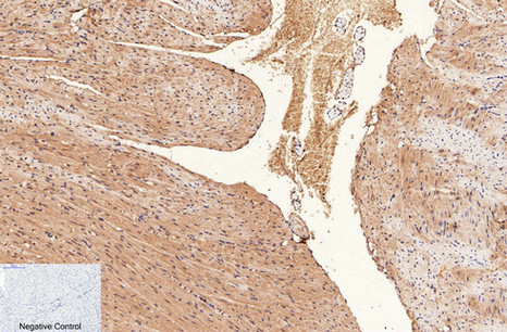 a00375 cd1a primary antibodies ihc testing 4