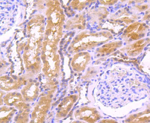 Immunohistochemical analysis of paraffin-embedded human kidney tissue using anti-EGF antibody