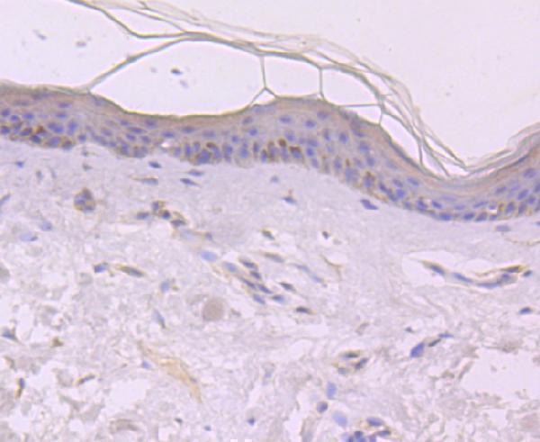 Immunohistochemical analysis of paraffin-embedded human skin tissue using anti-EGF antibody