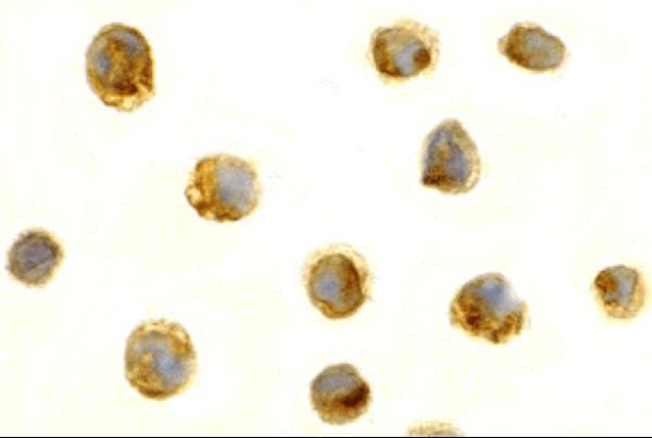 Immunocytochemistry Validation of Survivin in Jurkat Cells
Immunocytochemical analysis of Jurkat cells using anti-Survivin antibody (A00379-1) at 5 μg/ml