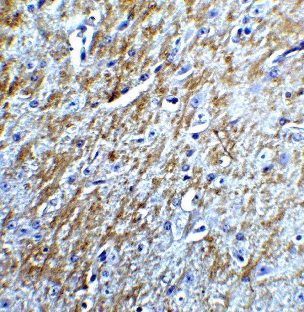 a00379 1 birc5 primary antibodies ihc testing 5