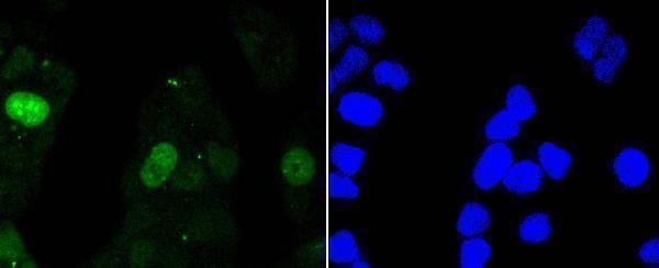 ICC staining Survivin in Hela cells (green)