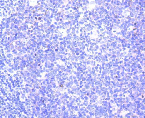 Immunohistochemical analysis of paraffin-embedded human tonsil tissue using anti-Survivin antibody