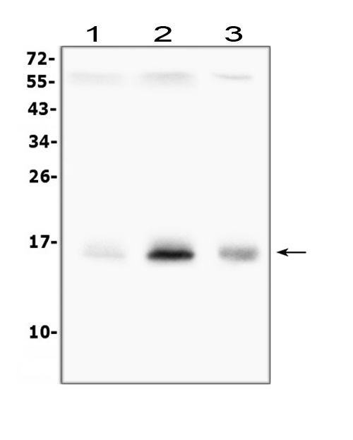 Western blot analysis of Survivin using anti-Survivin antibody (A00379). Electrophoresis was performed on a 5-20% SDS-PAGE gel at 70V (Stacking gel) / 90V (Resolving gel) for 2-3 hours. The sample well of each lane was loaded with 50ug of sample under reducing conditions. Lane 1: rat pc-12 whole cell lysate, Lane 2: human K562 whole cell lysate, Lane 3: mouse thymus tissue lysate. After Electrophoresis, proteins were transferred to a Nitrocellulose membrane at 150mA for 50-90 minutes. Blocked the membrane with 5% Non-fat Milk/ TBS for 1.5 hour at RT. The membrane was incubated with rabbit anti-Survivin antigen affinity purified polyclonal antibody (Catalog # A00379) at 0.5 μg/mL overnight at 4°C, then washed with TBS-0.1%Tween 3 times with 5 minutes each and probed with a goat anti-rabbit IgG-HRP secondary antibody at a dilution of 1:10000 for 1.5 hour at RT. The signal is developed using an Enhanced Chemiluminescent detection (ECL) kit (Catalog # EK1002) with Tanon 5200 system. A specific band was detected for Survivin at approximately 16KD. The expected band size for Survivin is at 16KD.
