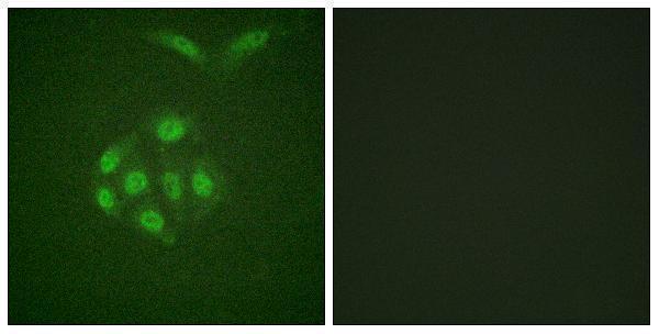 Immunofluorescence analysis of A549 cells, using Survivin (Phospho-Thr117) Antibody