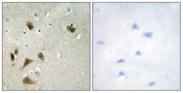 Immunohistochemistry analysis of paraffin-embedded human brain, using Survivin (Phospho-Thr117) Antibody