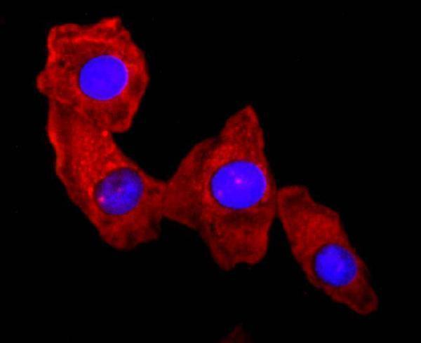 ICC staining S100A9 in A549 cells (red)