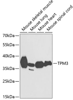 Western blot analysis of extracts of various cell lines, using TPM3 antibody  at 1:1000 dilution