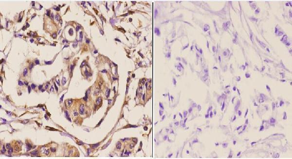 a00382 cdc20 primary antiboties ihc testing 2
