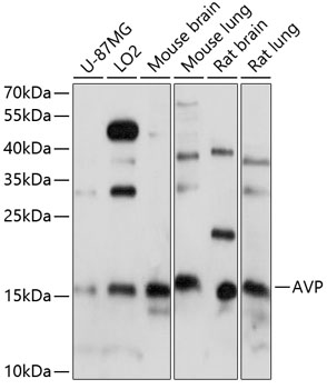 a00384 1 avp primary antiboties wb testing 1