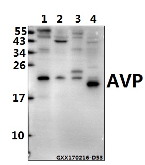 a00384 avp primary antiboties wb testing 1