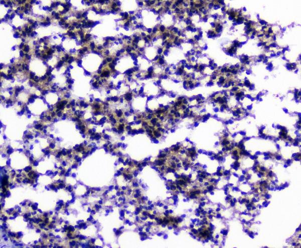 IHC analysis of CIC using anti-CIC antibody (A00385-1). CIC was detected in paraffin-embedded section of mouse lung tissues. Heat mediated antigen retrieval was performed in citrate buffer (pH6, epitope retrieval solution) for 20 mins. The tissue section was blocked with 10% goat serum. The tissue section was then incubated with 1μg/ml rabbit anti-CIC Antibody (A00385-1) overnight at 4°C. Biotinylated goat anti-rabbit IgG was used as secondary antibody and incubated for 30 minutes at 37°C. The tissue section was developed using Strepavidin-Biotin-Complex (SABC)(Catalog # SA1022) with DAB as the chromogen.