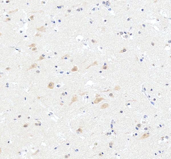 a00385 1 cic primary antibodies ihc testing 5
