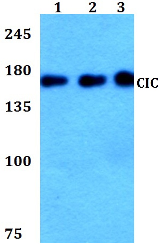 Western blot (WB) analysis of CIC polyclonal antibody at 1:500 dilution
Lane1:HEK293T whole cell lysate
Lane2:Raw264