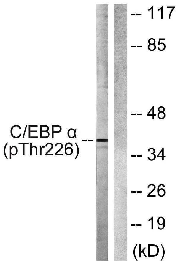 Western blot analysis of lysates from COS7 cells treated with EGF 200ng/ml 30', using C/EBP-alpha (Phospho-Thr226) Antibody