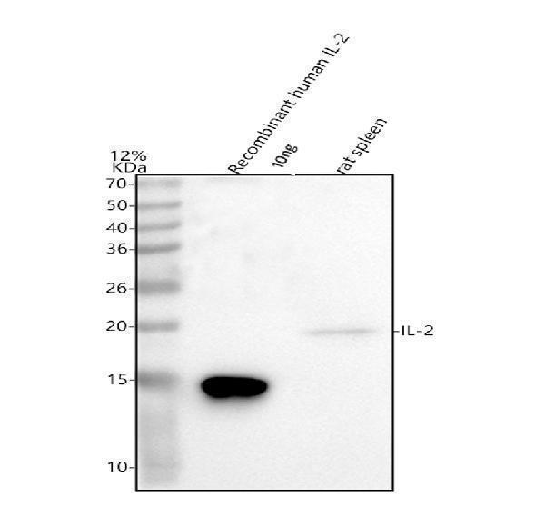  Western blot analysis of IL2 using anti-IL2 antibody (A00387-2)