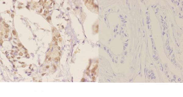 a00389 hnf4a primary antiboties ihc testing 2