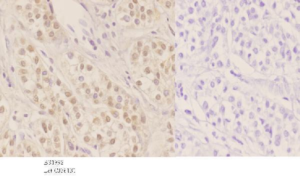 a00389 hnf4a primary antiboties ihc testing 3