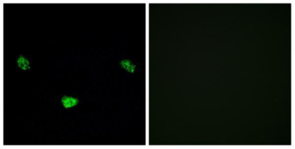 a00389s313 1 hnf4a primary antibodies if testing 5