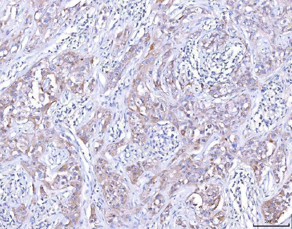 a00390 2 ccr7 primary antibodies ihc testing 1
