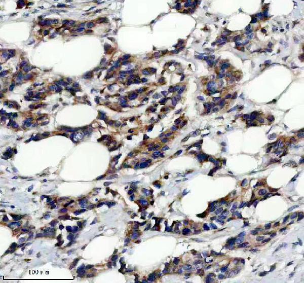 IHC analysis of RARA using anti-RARA antibody (A00392-1)