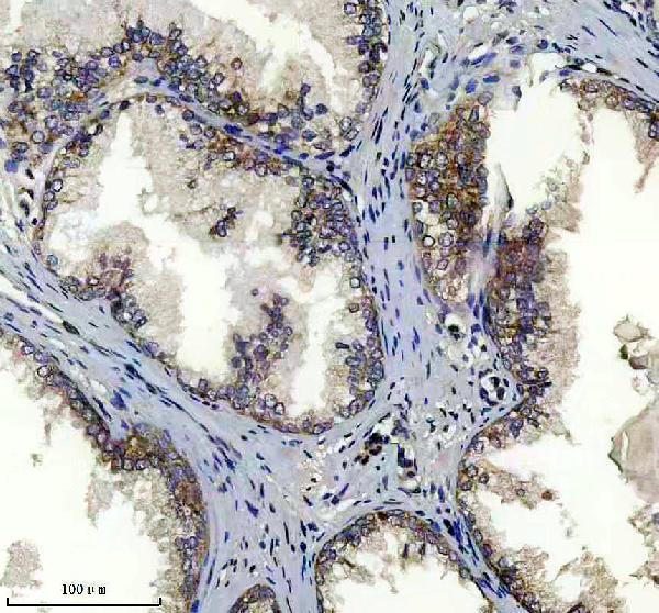 IHC analysis of RARA using anti-RARA antibody (A00392-1)