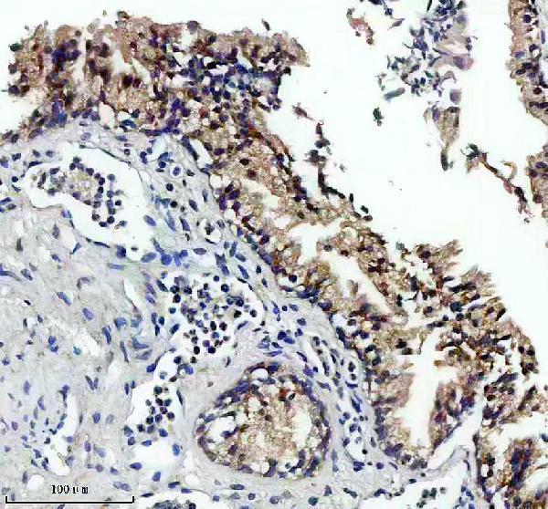 a00392 1 rara primary antibodies ihc testing 3