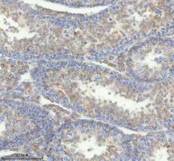 a00392 1 rara primary antibodies ihc testing 4