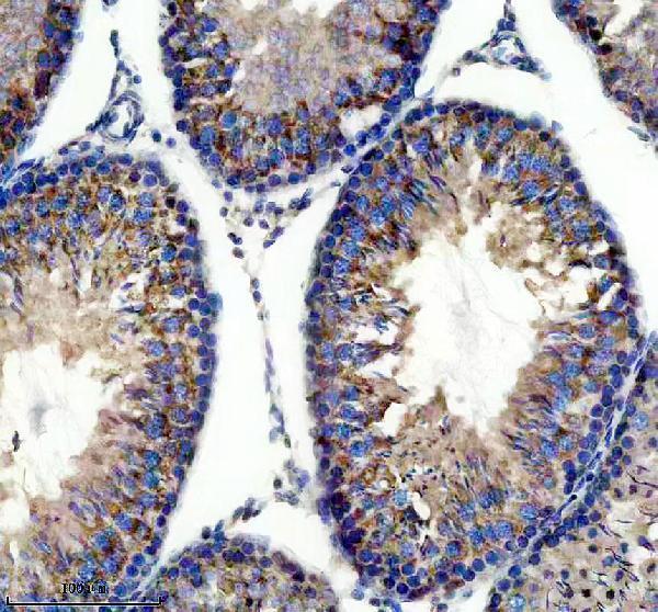 a00392 1 rara primary antibodies ihc testing 5