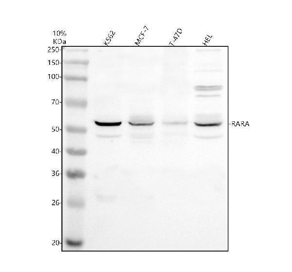 Western blot analysis of RARA using anti-RARA antibody (A00392-1)