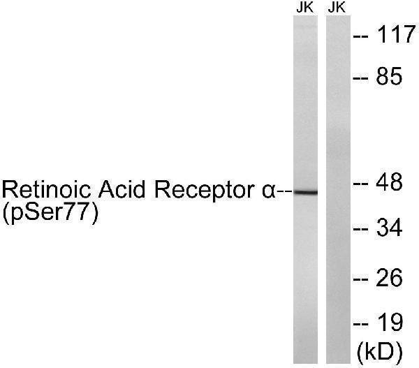 Western blot analysis of lysates from Jurkat cells treated with PMA 125ng/ml 30' and Jurkat cells treated with insulin 0
