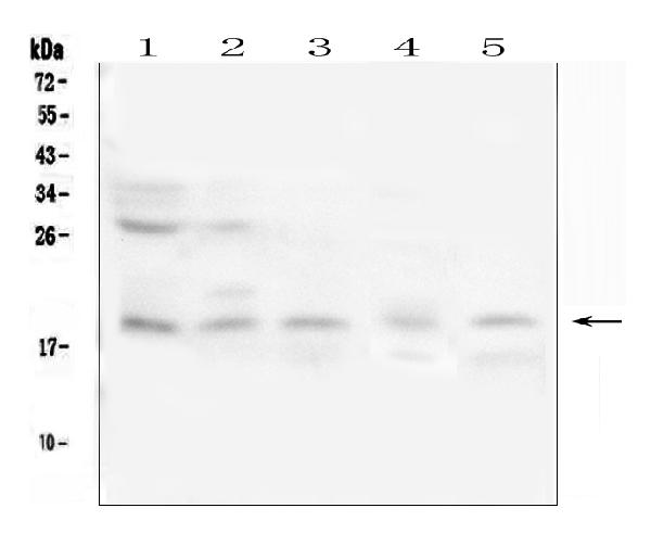 Western blot analysis of IFNG using anti-IFNG antibody (A00393-3). Electrophoresis was performed on a 5-20% SDS-PAGE gel at 70V (Stacking gel) / 90V (Resolving gel) for 2-3 hours. The sample well of each lane was loaded with 50ug of sample under reducing conditions. Lane 1: rat brain tissue lysates, Lane 2: rat lung tissue lysates, Lane 3: mouse brain tissue lysates, Lane 4: mouse ovary tissue lysates, Lane 5: mouse HEPA1-6 whole cell lysates. After Electrophoresis, proteins were transferred to a Nitrocellulose membrane at 150mA for 50-90 minutes. Blocked the membrane with 5% Non-fat Milk/ TBS for 1.5 hour at RT. The membrane was incubated with rabbit anti-IFNG antigen affinity purified polyclonal antibody (Catalog # A00393-3) at 0.5 μg/mL overnight at 4°C, then washed with TBS-0.1%Tween 3 times with 5 minutes each and probed with a goat anti-rabbit IgG-HRP secondary antibody at a dilution of 1:10000 for 1.5 hour at RT. The signal is developed using an Enhanced Chemiluminescent detection (ECL) kit (Catalog # EK1002) with Tanon 5200 system. A specific band was detected for IFNG at approximately 19KD. The expected band size for IFNG is at 19KD.